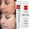 Whitening Freckle Cream Effective Remove Melasma Cream Remove Dark Spots Melanin Moisturize Brighten Smooth Face Skin Care 1