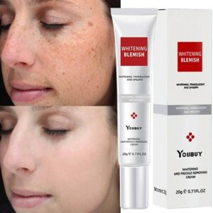 Whitening Freckle Cream Effective Remove Melasma Cream Remove Dark Spots Melanin Moisturize Brighten Smooth Face Skin Care 1