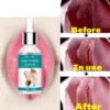 Buttocks Armpit Whitening Essence Skin Whitening Essence Remove