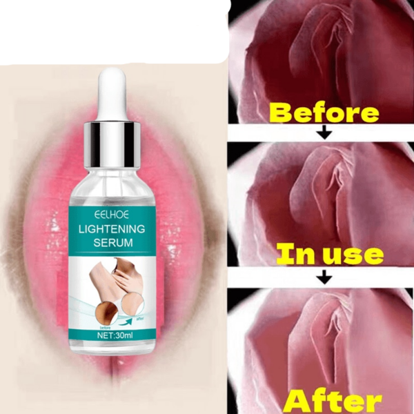 Buttocks Armpit Whitening Essence Skin Whitening Essence Remove