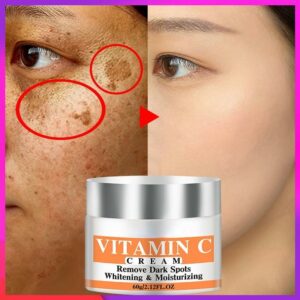 Whitening Facial Cream Repair Fade Freckles Remove Dark Spots Melanin Remover Brightening Face Cream 1