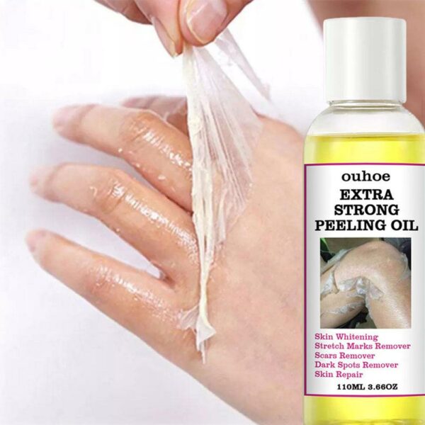 Extra Strong Yellow Peeling Oil Whitening Lighten Elbows Knees Hands Even Skin Tone Whiten Skin Care 1