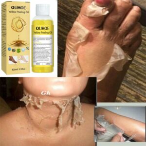 Yellow peeling oil Body Exfoliation strong Lighten elbows knees hands melanin even skin tone and whiten skin 1