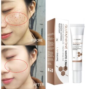 Whitening Spot Cream Freckles Removal Dark Spot Remover Lighten Spots Melanin Moisturizing Glutathione Face Cream Skin Care 1