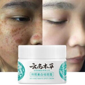 Herb Powerful Whitening Freckle Cream Remove Acne Spots Melanin Dark Spots Face Moisturizing Face Skin Care Beauty 2