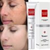 Whitening Freckle Cream Effective Remove Melasma Cream Remove Dark Spots Melanin Moisturize Brighten Smooth Face Skin Care