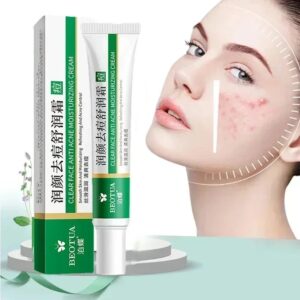 Herbal Acne Treatment Cream Face Scar Blackhead Remover Repair Gel Oil Control Shrink Pores Whitening Skin Care