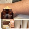 Follicle Skin Body Scrub Brighten Dark Spots Remove Smooth Moisturize Skin Care