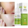 Anti Redness Soluation ,Spider Vein Removal Advanced treatment Clearer skin Veins on Face