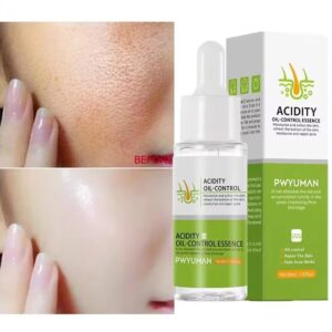 Anti Redness Soluation ,Spider Vein Removal Advanced treatment Clearer skin Veins on Face