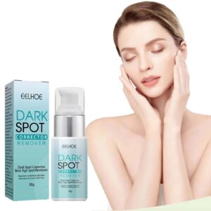 Whitening Freckles Cream Remove Melasma Dark Spot Lightening Melanin Removal Melasma Remover Moisturize Brighten Face Skin Care