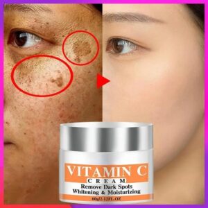 Whitening Facial Cream Repair Fade Freckles Remove Dark Spots Melanin Remover Brightening Face Cream