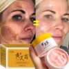 Whitening Freckles Face Cream Remove Dark Spots Melasma Lighten Melanin Acne Scars Anti-aging Brighten Skin Care