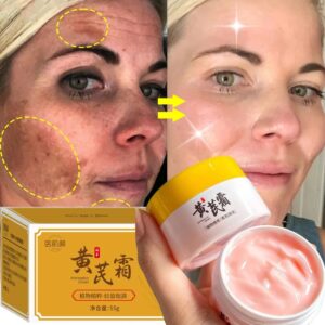 Whitening Freckles Face Cream Remove Dark Spots Melasma Lighten Melanin Acne Scars Anti-aging Brighten Skin Care