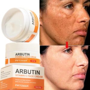 Whiten Freckle Cream Fast Remove Melasma Melanin Correcter Anti-Pigmentation Dark Spot Fade Improve Dullness Skin Care