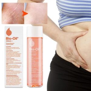 Stretch Marks Removal Essential Oils Body Skin Care Stretch Marks Remover Obesity Postpartum Anti-wrinkle Repair Oils