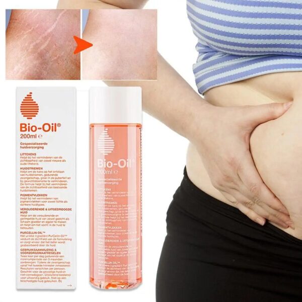 Stretch Marks Removal Essential Oils Body Skin Care Stretch Marks Remover Obesity Postpartum Anti-wrinkle Repair Oils