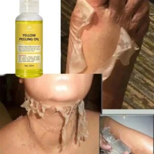 Body Care Exfoliating Yellow Peeling Oil Organic Bleaching Dark Skin Serum Dark Knuckles Fast Whitening