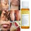 Yellow peeling oil Body Exfoliation strong Lighten elbows knees hands melanin even skin tone and whiten skin