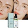 Whitening Essence lighten freckles effective brightening essence remove pigment melanin correct beauty facial skin care