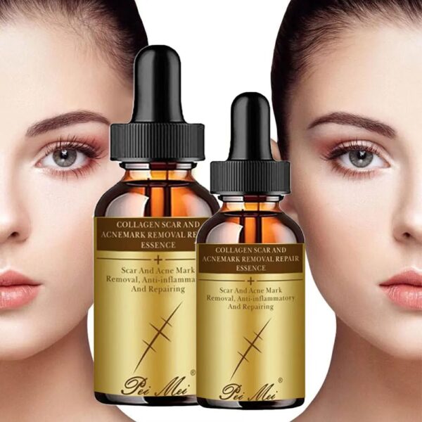Thin Arm Slimming Essence Essential Oils Massage Burning Fat Weight Loss Ginger Essential Oil Shaping Lifting Firming