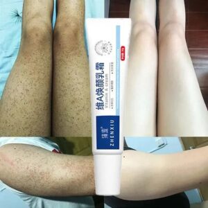Body Whitening Cream Keratosis Pilaris Treatment Bumpy Rough Chicken Follicle Skin Repair Strawberry