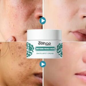 Whitening Freckles Face Cream Remove Melasma Dark Spots Lighten Melanin Acne Scar Anti-aging Brighten Face Skin Care