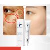 Spot Cream Remove Chloasma Eliminate Dark Spots Brighten Skin Tone Face Skin Care Products Improves Dull Skin