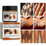 Dark Colored Quick Whitening Cream Skinpowerful Stain Remover Knuckles Correction for Dark for Knuckles Elbows