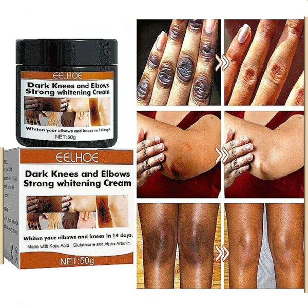 Dark Colored Quick Whitening Cream Skinpowerful Stain Remover Knuckles Correction for Dark for Knuckles Elbows