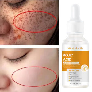 Acid Freckle Removing Whitening Essence Fade Pigmentation Melasma Dark Spots Corrector Repair Serum Korean Skin Care