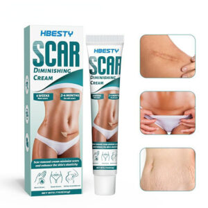 Stretch Mark Removal Cream Skin Repair Cream Scar Lightening Acne Spot Acne Treatment Blackhead Whitening Cream Skin Care