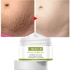 Pregnancy Repair Cream Stretch Mark Removal Removal Acne Scar Stretch Marks Cream Fat Striae Gravidarum Treatment Body Creams