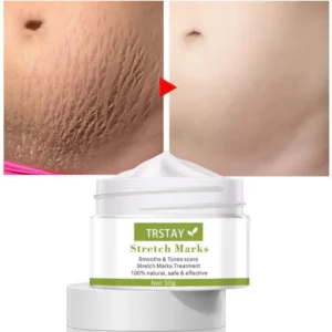 Pregnancy Repair Cream Stretch Mark Removal Removal Acne Scar Stretch Marks Cream Fat Striae Gravidarum Treatment Body Creams