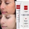 Whitening Freckle Cream Effective Remove Melasma Cream Remove Dark Spots Melanin Moisturize Brighten Smooth Face Skin Care