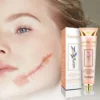 Yoxier Lavender Scar Repair Cream Acne Scar Removal Remove Pigmentation Scar Marks Stretch Smooth Skin Care Whitening Cream