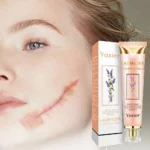 Yoxier Lavender Scar Repair Cream Acne Scar Removal Remove Pigmentation Scar Marks Stretch Smooth Skin Care Whitening Cream