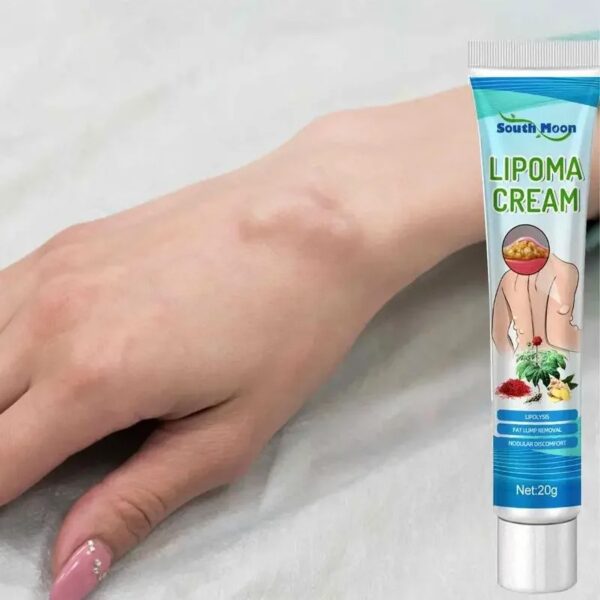 Treatment Cream Lipolysis Removal Skin Tumor Swelling Pain Ointment Plaster Relief Exfoliating Cellulite