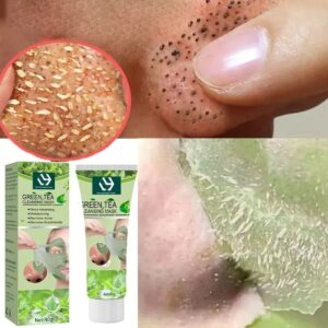 Blackhead Remover Mask Nose Face Skin Care Green Tea Extract Deep Cleansing Whitening Shrink Pore Peeling Acne Treatment