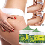 Marks Removal Cream Body Buttock Repairing Whitening Pregnancy Stretch Scar Mark Remover Skin Care Cream