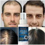 Hair Growth Serum Spray Prevent Anti Hair Loss Products Fast Growing Hair Care Oil Scalp Treatments Beauty Health