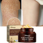 Repair Treatment Cream Cleaning Acne Spots Removal Chicken Skin Goose Bumps Whitening Smooth Body Skin Care