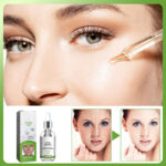 Anti-spot Remove freckles, chloasma, dark spots, hyperpigmentation, age spots, sun spots, whitening light spots