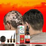Fast Hair Growth Effective Baldness Repair Hereditary Hair Loss Postpartum Hair Loss Seborrheic Hair Anti Loss Hair Growth Oil