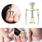 Straightening Clip Ingrown Toenail Corrector Pedicure Tool Paronychia Cure Corrector Clip Relief Pain Health Foot Nail Care