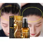 Hair Growth Products Biotin Fast Growing Hair Care Essential Oils Anti Hair Loss Spray Scalp Treatment for Men Women