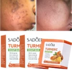 Soap Bar for Face & Body-Tumeric Soap,Acne, Dark Spots, Smooth Skin,Cleansing Natural Handmade Soap