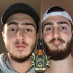 Fast Beard Growth Oil Beard Oil for Men Caffeine Natural Beard Growth Serum Promote Hair Regrowth Professional