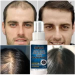 Powerful Hair Growth Serum Spray Prevent Hair Loss Essential Oil Fast Growing Repair Nourish Scalp Treatment For Men