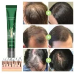 Hair Growth Oil - Biotin Serum Treatment for Stronger Thicker Longer Hair – Natural Hair Growth Thickening Treatment